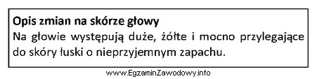 Opis dotyczy zmian na skórze głowy charakterystycznych dla