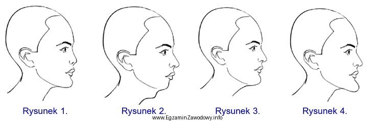 Na którym rysunku schematycznym przedstawiono wysuniętą brodę?