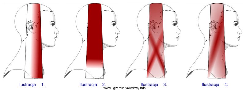 Która ilustracja przedstawia odbarwienie będące efektem rozjaś