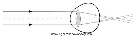 Zamieszczony rysunek przedstawia astygmatyzm