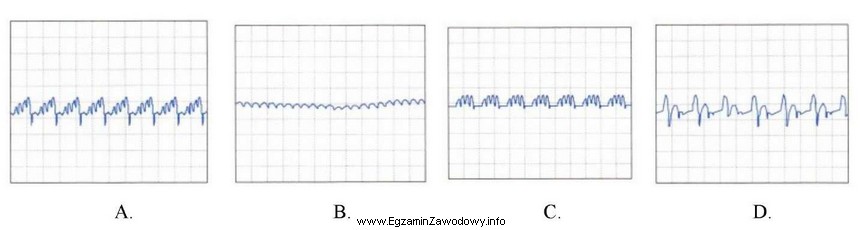 Który z oscylogramów przedstawionych na rysunkach, odczytany z 