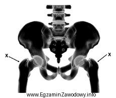 Które struktury kostne wskazano znakiem X na ilustracji?