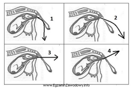 Który kierunek wyciągania płodu krowy przy uż