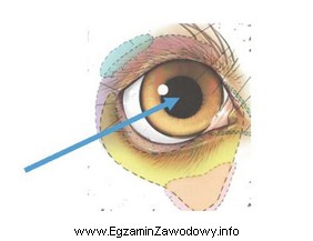 Na rysunku przedstawiającym oko psa strzałka wskazuje