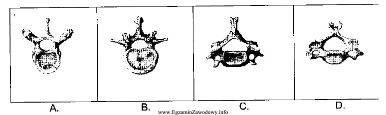 Na rysunkach przedstawiono wybrane kręgi kręgosłupa. Krę