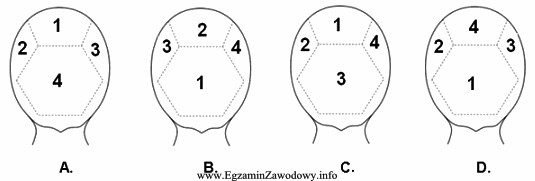 Na którym z rysunków został przedstawiony podział wł