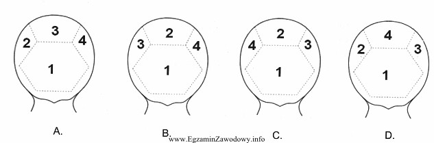 Na którym z rysunków został przedstawiony poprawny podział 