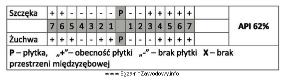 Badając jamę ustną pacjenta za pomocą wskaźnika API, higienistka 