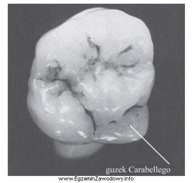 Na którym zębie trzonowym stałym występuje 