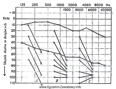 Audiogram przedstawia próbę