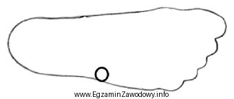 Która struktura anatomiczna została oznaczona na obrysie stopy?